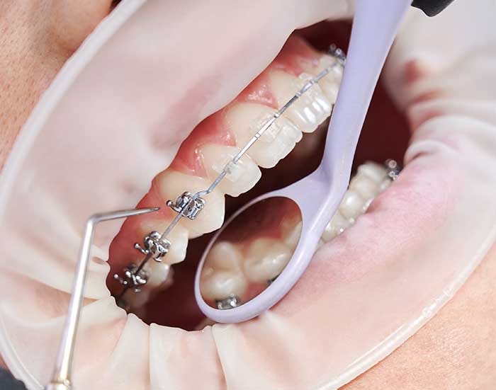 Dentista - ortodoncia