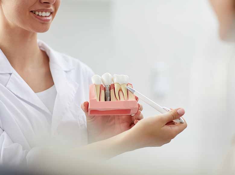 Muestra de implante dental