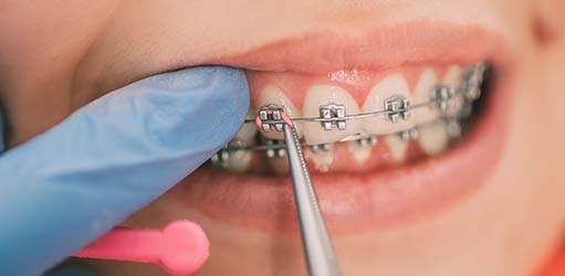 revisión ortodoncia