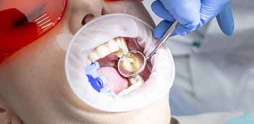 Trabajo dental Trabajo dental