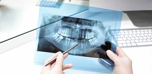 Rayos x dental Imagen rayos x dental